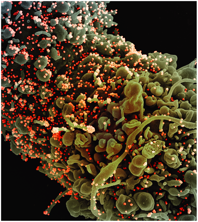 Study Aims to Identify Drugs That Could Be Repurposed for COVID-19