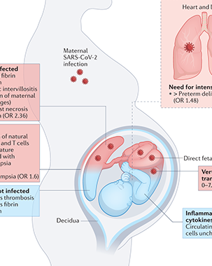 COVID-19 mRNA Vaccine Booster During Pregnancy Increases Maternal and Fetal Antibodies title=